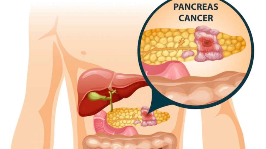 Don’t Forget To Ignore Inflammation In The Pancreas, Know Its Symptoms And Prevention In Time